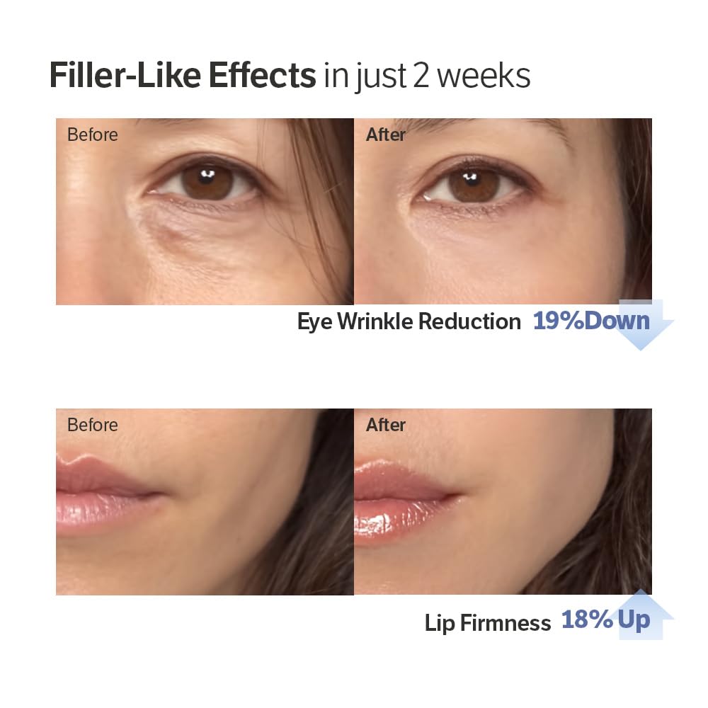 HOAOT Volufiline-Infused Korean Collagen Serum