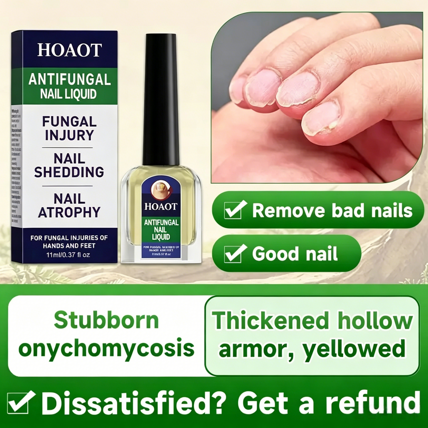 Say Goodbye to Yellow, Thick & Itchy Toenails – Triple Action Fungus Relief Formula