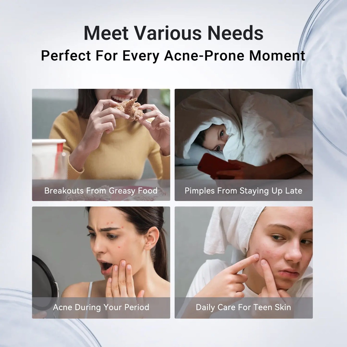 Acne Treatment Lotion | 24H Pimple Care & 7-Day Scar Fade | 1.8% Salicylic Acid, 4% Niacinamide & 10% Sulfur