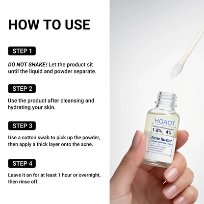 Acne Treatment Lotion | 24H Pimple Care & 7-Day Scar Fade | 1.8% Salicylic Acid, 4% Niacinamide & 10% Sulfur
