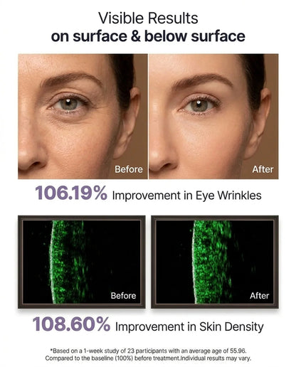 HOAOT Volufiline-Infused Korean Collagen Serum
